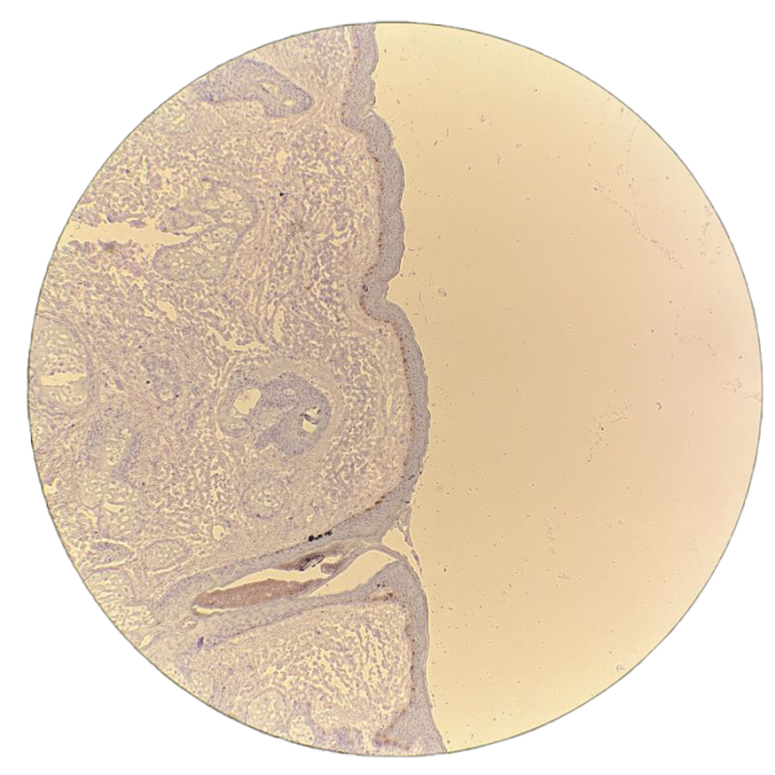 MohsPros Immunohistochemistry stain (IHC).