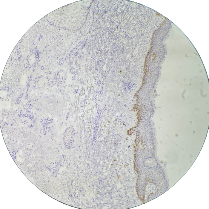 Technicians know how to stain using IHC techniques at MohsPros.